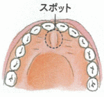 歯のスポット