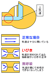 いびきのメカニズム