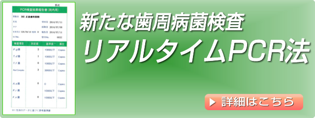 新しい歯周病菌検査 リアルタイムPCR法